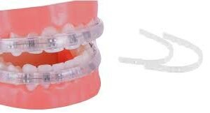 Protège-Lèvres Orthodontique - Remplace la Cire